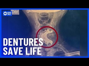 81-Year-Old Man's Life Saved After Swallowing Dentures | 10 News First