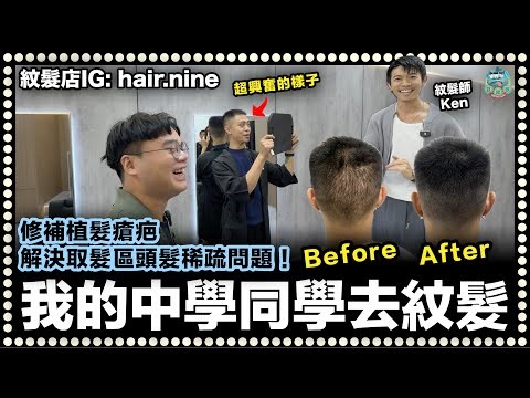 [頭髮] 我的中學同學去紋髮！修補植髮帶來的瘡疤解決取髮區視覺頭髮稀疏問題！效果太絕了！| Hair Nine