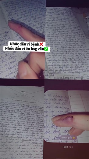 Mỏi tay #viral #fyp