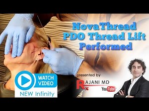 Watch NEW MOLDED THREAD LIFT- PDO Infinity from NovaThreads Before and After