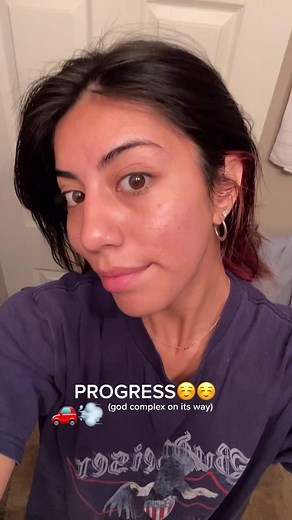 #skincare #acne #month7