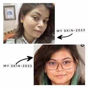 3.8K reactions · 265 shares | Skin texture যে আসলেই পরিবর্তন হতে পারে...