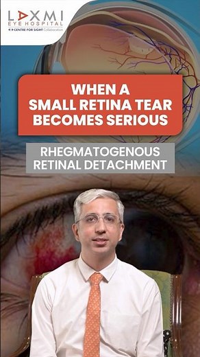 Retinal Tear: The Most Common Cause of Retinal Detachment | Dr. Devendra Venkatramani