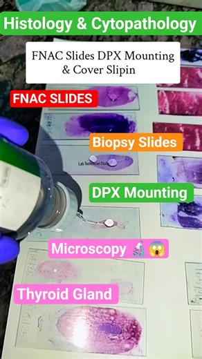 Histopathology & Cytopathology Slides Microscopy #lab #shorts #short