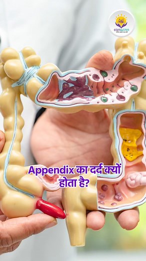 3.3K views · 68 reactions | Appendix का दर्द क्यों होता है? . . Follow - @officialcanwinn . . Hashtags #appendix #appendixcancer #pain #stomachpain #smallintestine #largeintestine #intestine #evolution #pollutedwater #stonestool #swelling #infection #blockage #bacteria #canwinn #apna_canwinn_hai_na | CanWinn Foundation | Facebook