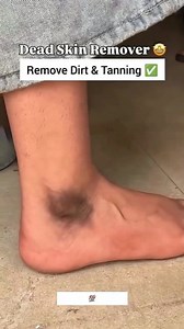 1.2M views · 3.6K reactions | Clean Feet Dirt & Darkness At Home | Get Rid Of Dark Ankle, Feet Whitening Tips #skincare #darkankle #feetcare #fairfeet #fbviral #fbtrendingreels # | Health Beauty Treat | Facebook