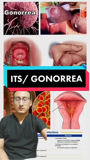 Gonorrea: Síntomas, Diagnóstico y Tratamiento