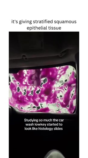 Girlyyscasm🎀 on Instagram: "it's giving stratified squamous epithelial tissue (Via:_audge_paudge_/tt)"