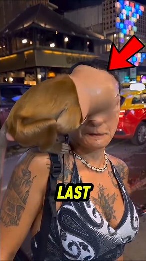 These Are the Weirdest Body Mutations in Real Life — The Last One Looks Sci-Fi 👽 #shocking #record