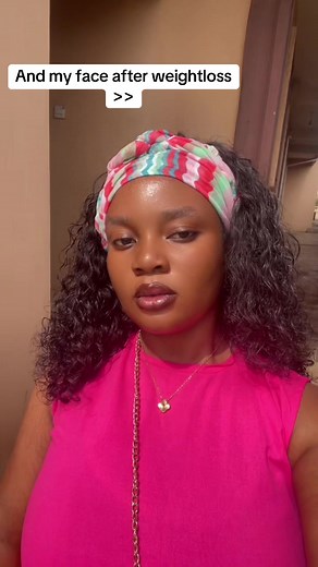 My face before and after weigtloss 🙈#weightlossgoals #weightlossjourneys #weightlossmotivation #weightlossjourney2024