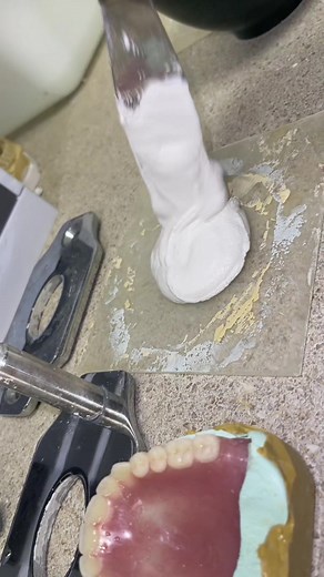 Understanding the Reline Process: Side Effects and More