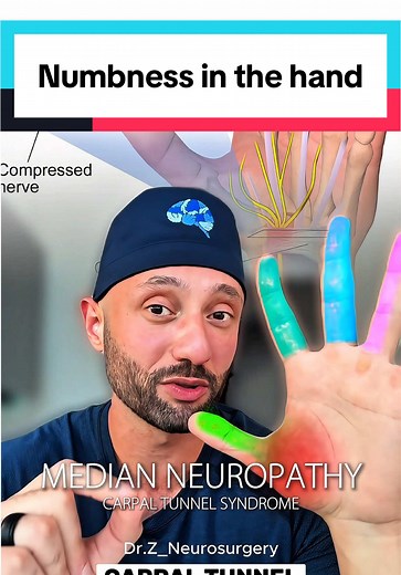 Identifying Nerve Entrapment Causes for Hand Numbness