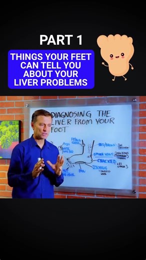 1.3K views · 18 reactions | THINGS YOUR FEET CAN TELL YOU ABOUT YOUR LIVER — PART 1 禮 Your feet might be sending signals about liver health! Learn what to watch for and keep your liver in check  #HealthTips #drericberg #liverhealth #foothealth #wellness #nutrition #holistichealth #healthtips #detox #naturalremedies #healthyhabits | Diet & healthy By Dr | Facebook