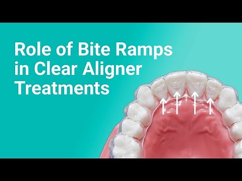 Bite Ramps in Clear Aligner Treatments: Orthodontic Expertise Unveiled