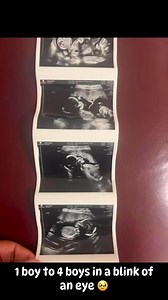 Triplet Pregnancy Journey. The sweetest gift. #triplets #tripletboys #boymom #multiplepregnancy | Sadie Sirls
