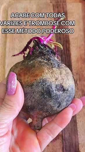 Diga Adeus às Varizes com Receita Caseira Poderosa