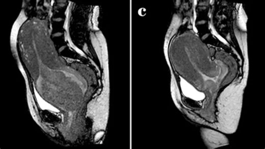 Woman gave birth inside MRI scanner to reveal the mechanics of childbirth in insane first