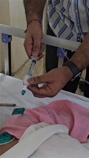 Epidural Anesthesia | How to give Epidural Anesthesia | Doctor Strange #mbbs #neetpg #anesthesia