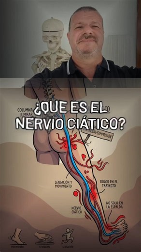 ¿QUÉ ES EL NERVIO CIÁTICO? 🧠🦵