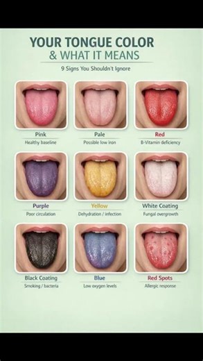 9 Tongue Colors & What They Reveal About Your Health