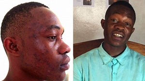 68K views · 1.1K reactions | "So how exactly does Kernel Fresh work?" Watch this short video to hear from a young Liberian guy about how Kernel Fresh helped clear his pimples and dark spots. If you have any questions, call us on 0770537635. Spread the word! | Kernel Fresh by J-Palm Liberia | Facebook