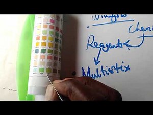 Chemical properties of urine