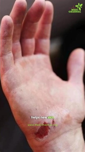 Why Your Wound Isn’t Healing Fast?