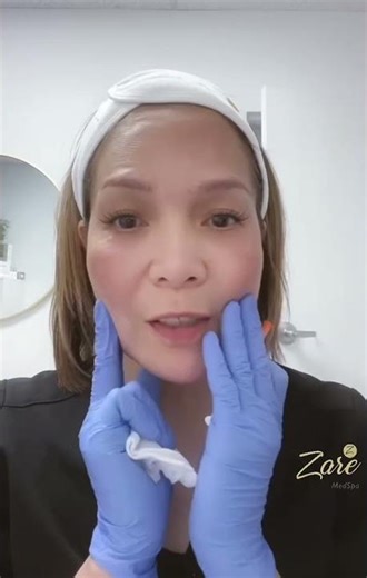 Lower Face Botox: Technique & Placement for Natural Lift