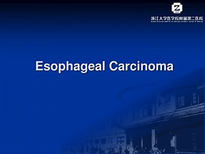 Esophageal Carcinoma - SlideServe