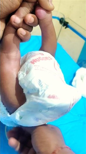 Checking Your Newborn BABY's Diaper Every Hour? 🍼👶Newborn Care Tips for Parents#Newborn#DiaperChange