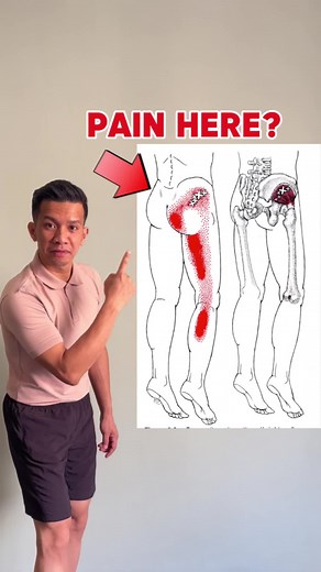 PHYSICAL THERAPY SESSION on TikTok