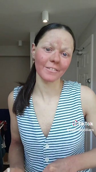 Understanding Hearing Loss and Skin Conditions