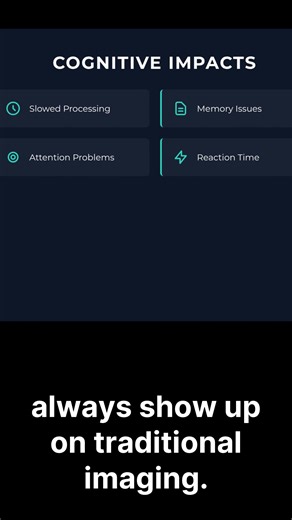 🔴A Normal Brain Scan Does NOT Mean a Normal Brain CT scans and MRIs are critical tools, but they often fail to detect cognitive and functional deficits caused by mild traumatic brain injury. A “normal” scan does not mean normal brain function. Issues like brain fog, slowed processing, memory problems, and delayed reaction time don’t always appear on imaging, but they absolutely affect real life. This is why objective cognitive and neurological testing is essential when evaluating TBI, especiall
