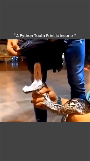 Matrix Core on Instagram: "Pythons are powerful constrictors, but they also leave behind a chilling reminder of their bite distinct tooth prints. Unlike venomous snakes, pythons rely on their backward-curved teeth to latch onto prey and hold tight while they coil and suffocate their target. These sharp teeth can puncture deeply, leaving patterned wounds that show exactly how the snake's jaws are arranged. Even though pythons are nonvenomous, their bite can be painful, infectious, and a vivid exa