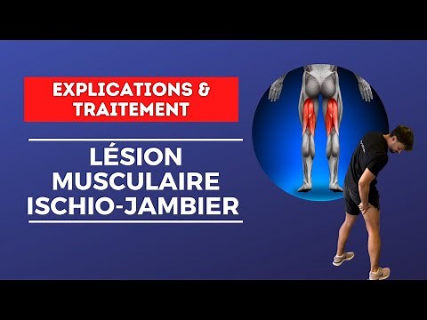Optimiser la rééducation des lésions musculaires des ISCHIO-JAMBIERS - Explications & traitement
