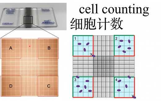 如何使用hemocytometer细胞计数/ cell counting