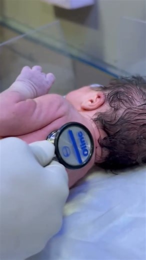 Baby First Assessment 😍😍😍#chekup #viral #newborn #neonate