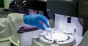 Šta pokazuje D-dimer i kako je povezan sa koronom