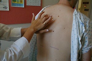 Objective examination: what is percussion and why is it done?