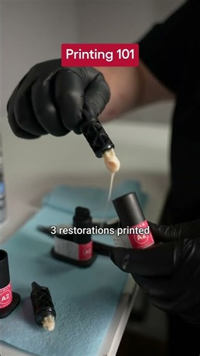How to 3D Print 3 Restorations at Once with Midas Digital Printer #shorts