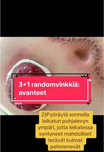 PS. Irroita avanteen pohjalevy AINA käyttäen liimanirrotussuihketta. ☝️#hoitotyö #hoitajattiktokissa #sairaanhoitaja #lähihoitaja #sairaanhoitajaopiskelija #lähihoitajaopiskelija