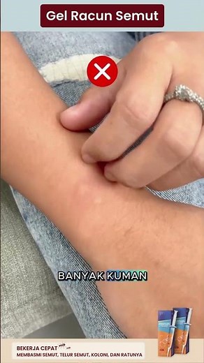 Cara Praktis Atasi Semut di Rumah