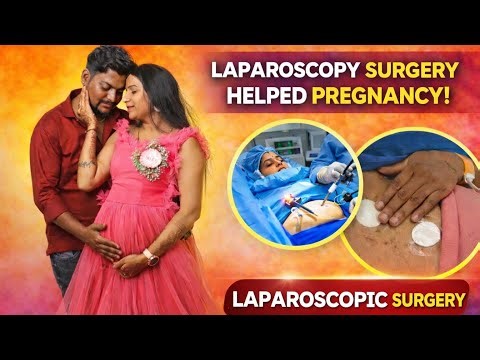 My laproscopy journey story🥹🥹🥹 | How helped laproscopy getting pregnancy positiv🤰🏻