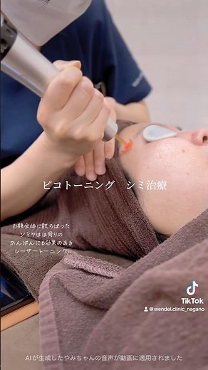 顔全体に散らばったシミや肝斑にはピコトーニングでコース施術が効果的🐰🦋施術中、症例あり#shorts #ウェンデルクリニック#美容皮膚科 #シミ治療 #ピコトーニング