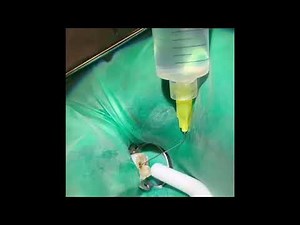 Root canal therapy of tooth 31 from start to finish!