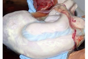 The most incredible photo of an en caul birth - Netmums
