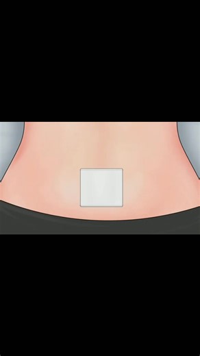 Large Navel stone | Removal & Treatment cleaning Animation video | #3danimation #animation #health #followers #asmr #cleaning | Akhilesh Yadav