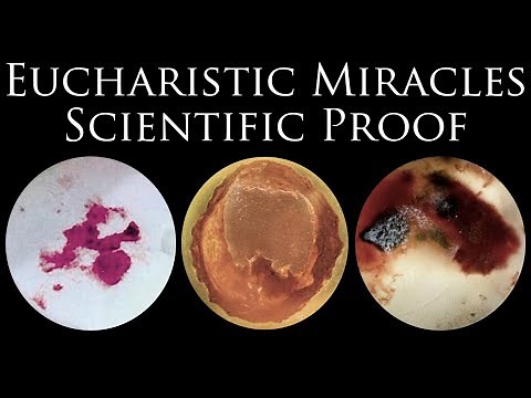 Eucharistic Miracles: Scientific Proof that Eucharist is the Body of Christ