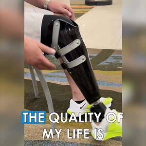 Conventional sockets are hot, rigid and often uncomfortable. The Socket-less Socket™ is breathable, conforming and has micro-adjustable comfort. | Martin Bionics
