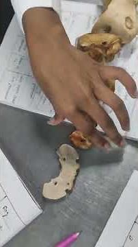 Atlas - Comparative anatomy